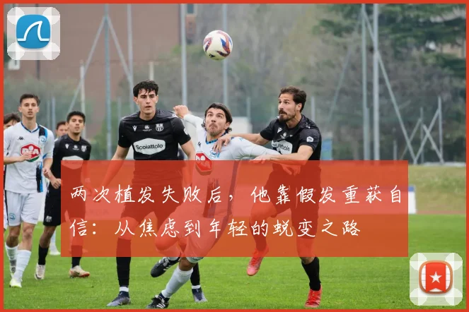 两次植发失败后，他靠假发重获自信：从焦虑到年轻的蜕变之路